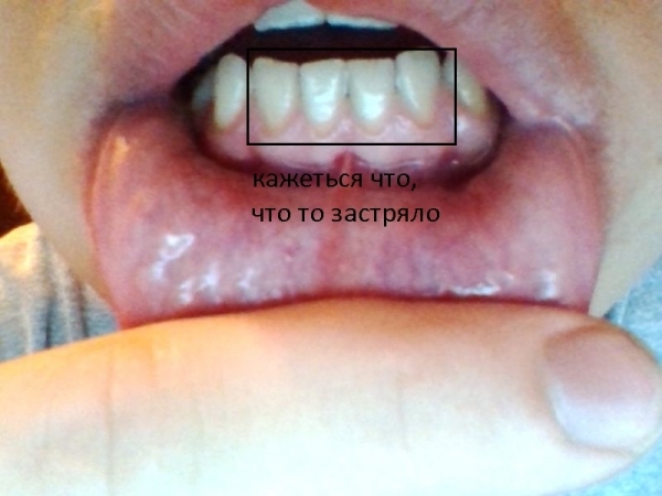 Как будто между зубами застряло что-то