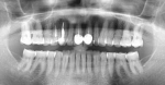 может ли зуб вообще не болеть