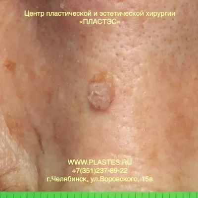 Центр Пластэс