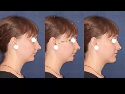 Центр Пластэс