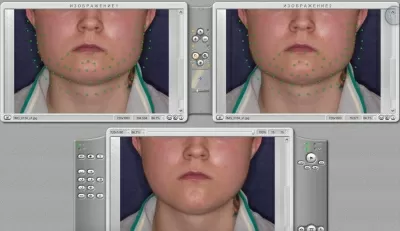 Центр Пластэс