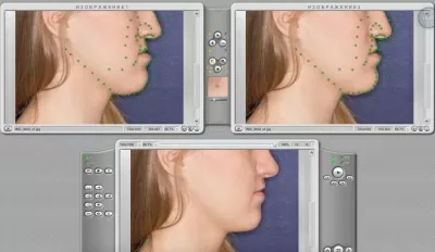 Центр Пластэс