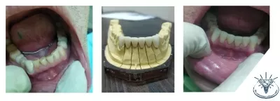 Белая стоматология