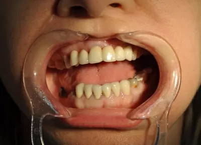 Дентал Премиум