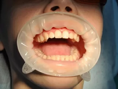 Дентал Премиум