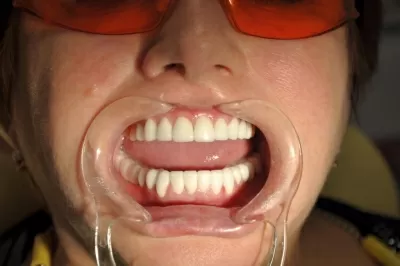 Дентал Премиум