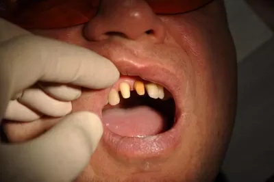 Дентал Премиум