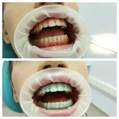 Дентал Эконом