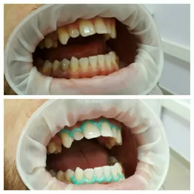 Дентал Эконом