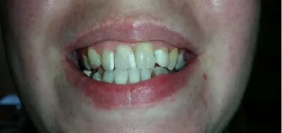 Золотой век