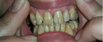 Золотой век