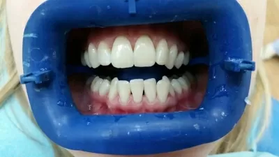 Золотой век