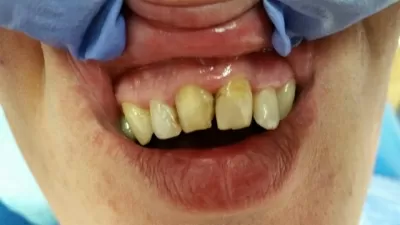 Золотой век