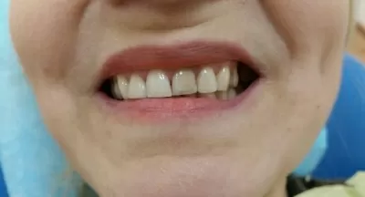 Золотой век