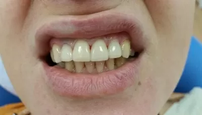 Золотой век