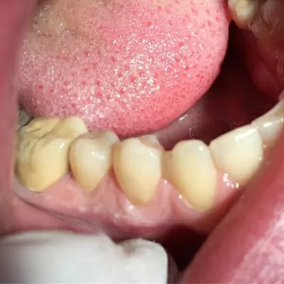 Альтернативная стоматология