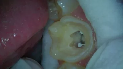 Альтернативная стоматология