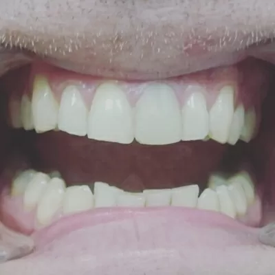 Альтернативная стоматология