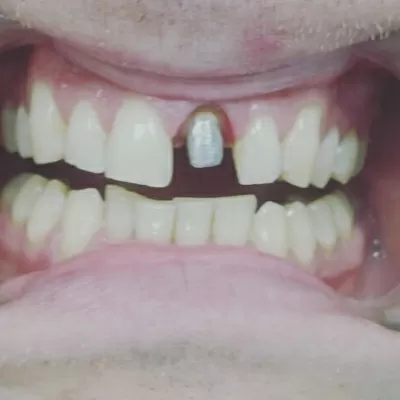 Альтернативная стоматология