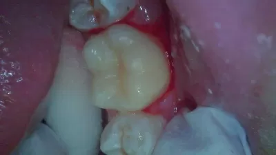 Альтернативная стоматология