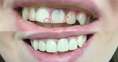 Кёнигсдент