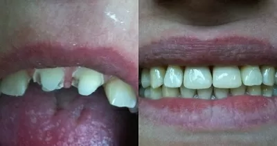 Кёнигсдент