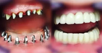 Кёнигсдент