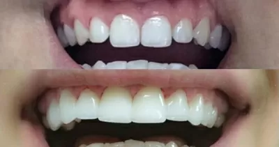 Кёнигсдент