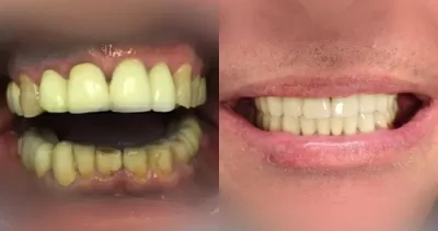 Кёнигсдент