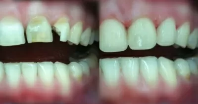 Кёнигсдент