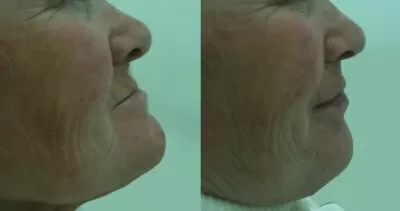 Кёнигсдент