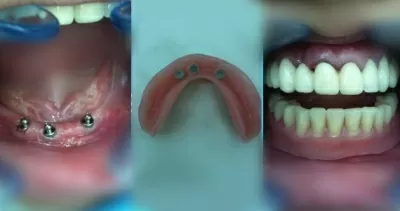 Кёнигсдент