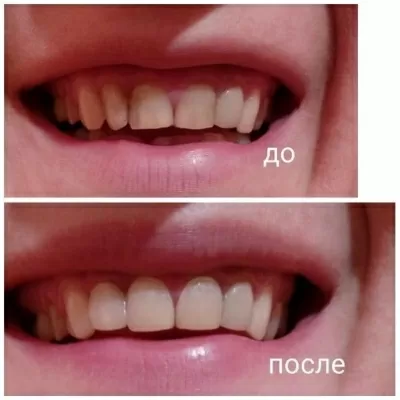 Дантист Люкс