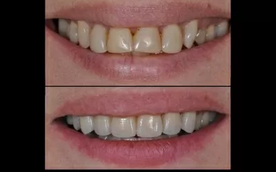 Орал Клиник