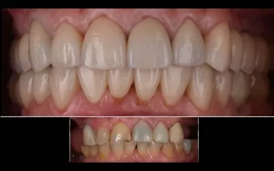 Орал Клиник