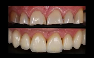 Орал Клиник