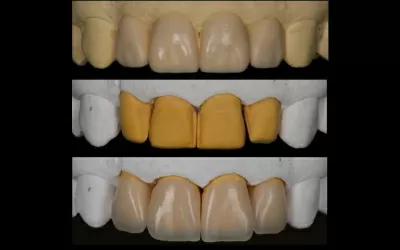 Орал Клиник