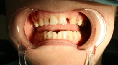 Эстетик лайф