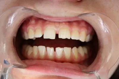 Эстетик лайф