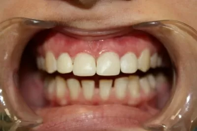 Эстетик лайф