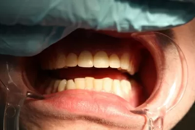 Эстетик лайф