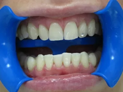 Стевия Фемели