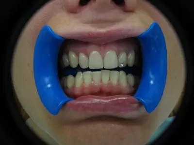 Стевия Фемели