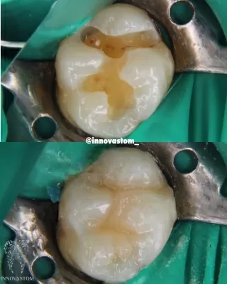 ИННОВАСТОМ