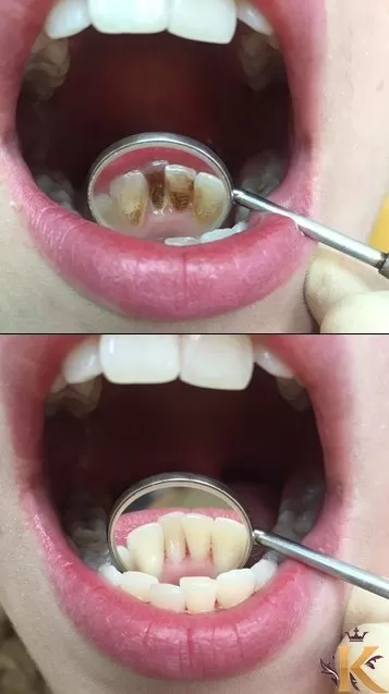 Студия эстетической стоматологии и имплантации доктора Королева