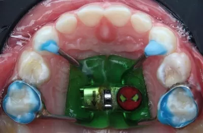 Студия эстетической стоматологии и имплантации доктора Королева