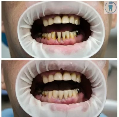 Оптима Дент