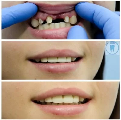 Оптима Дент