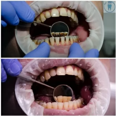 Оптима Дент