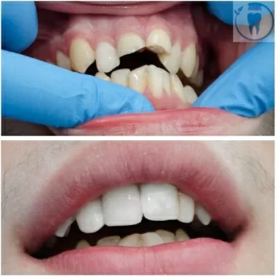 Оптима Дент